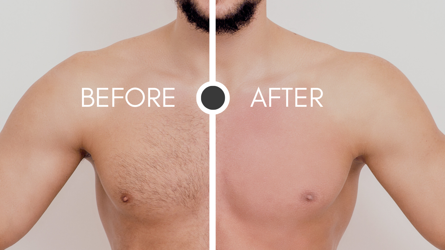Male Waxing Before And After