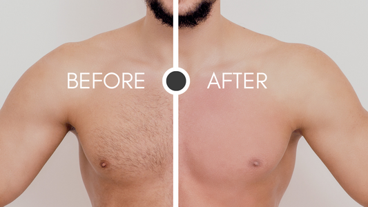 Waxing Men Before & After